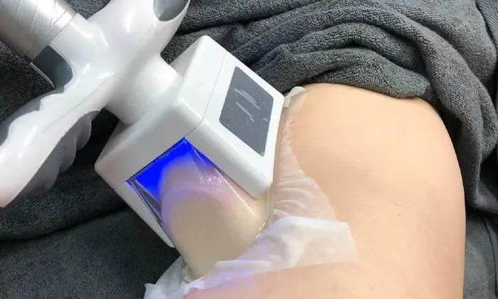 Cryolipolysis Treatment Including Ultrasonic Cavitation and Radio Frequency Treatment from La Glace Beauty Clinic